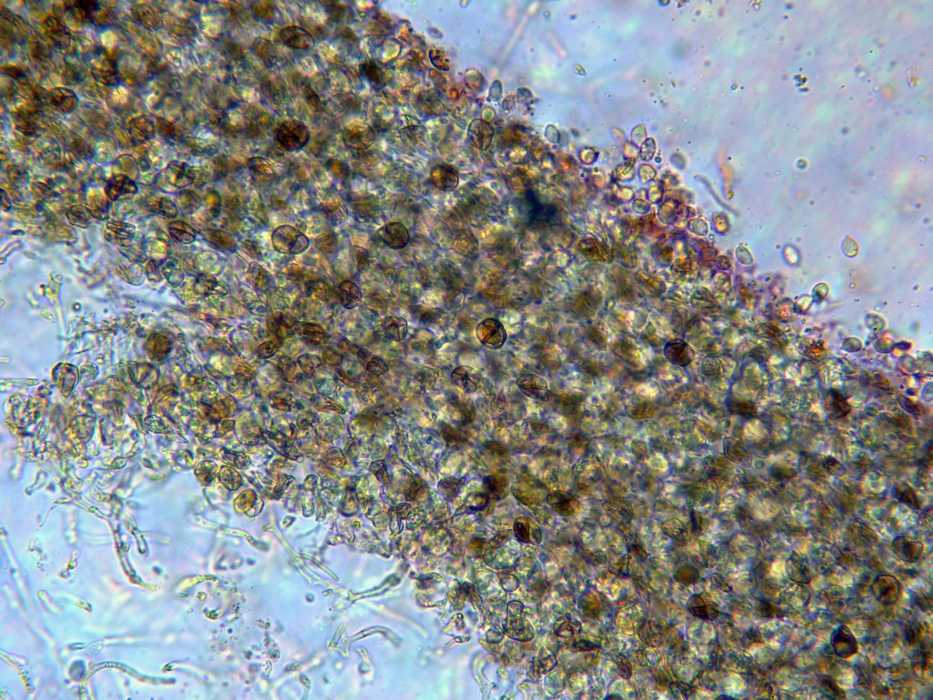 Microscopía de Phaeotremella foliacea - 5 - Exterior x 400-001